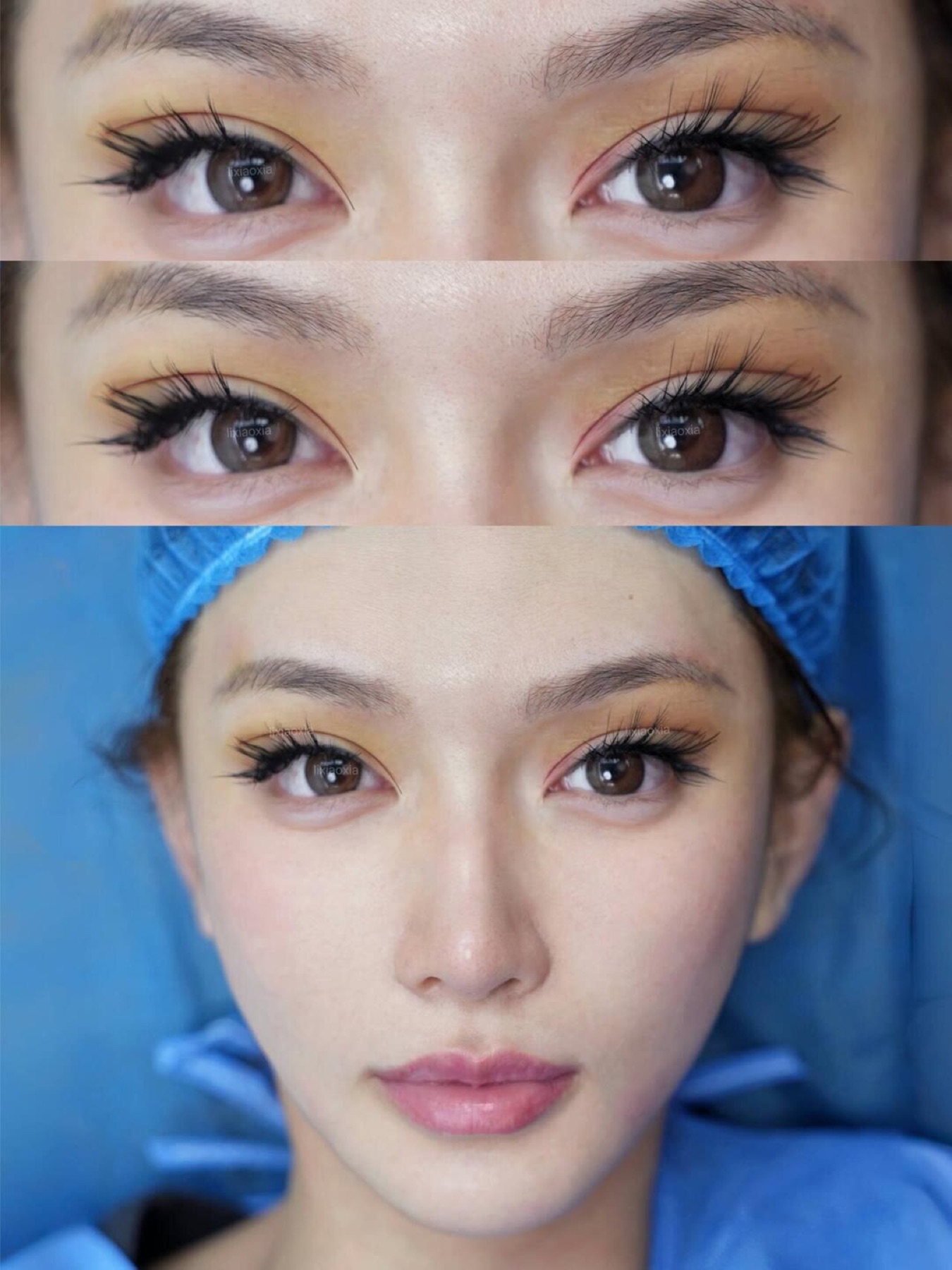 Consented Baby Face case 49