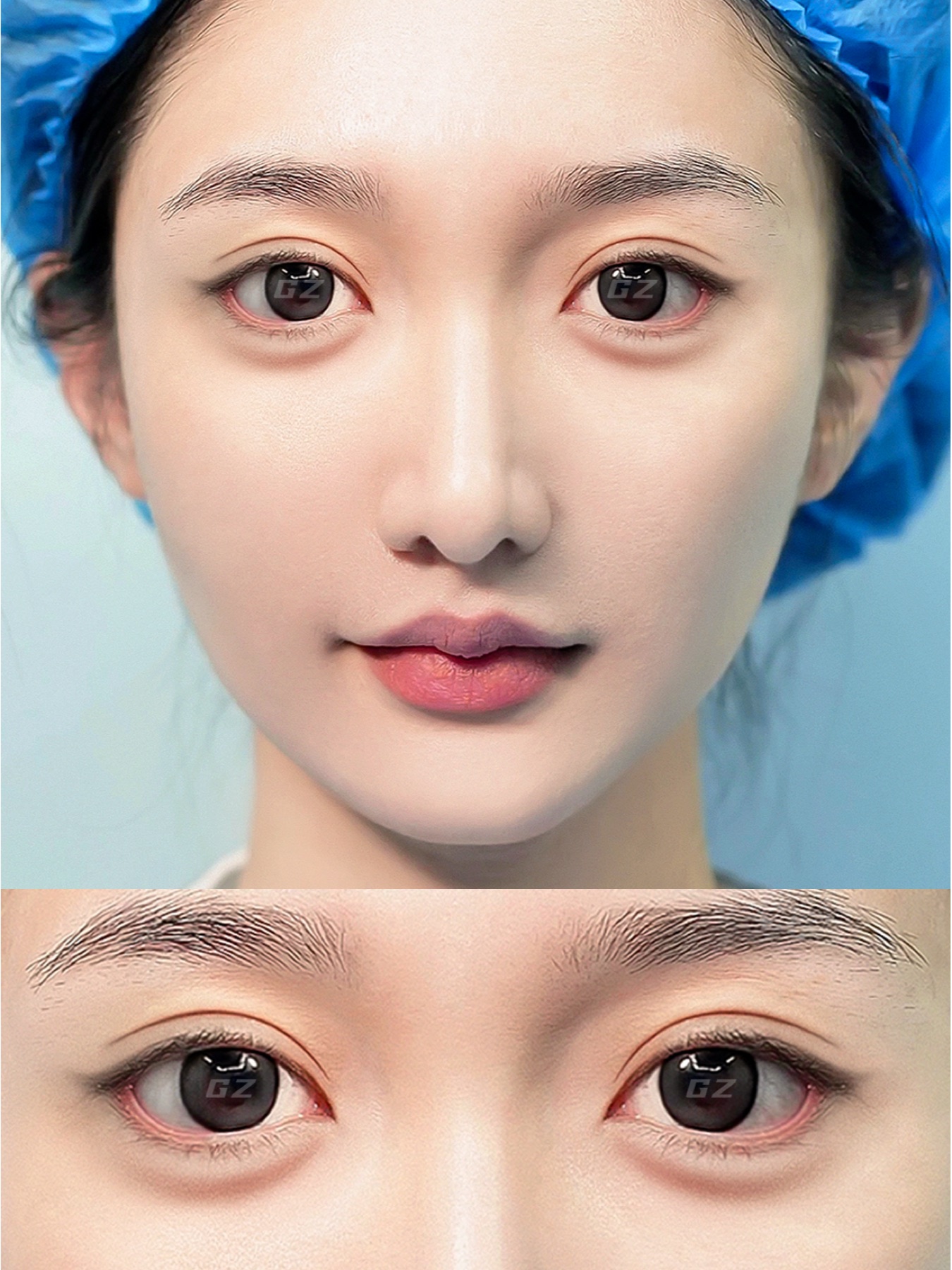 Consented Baby Face case 13