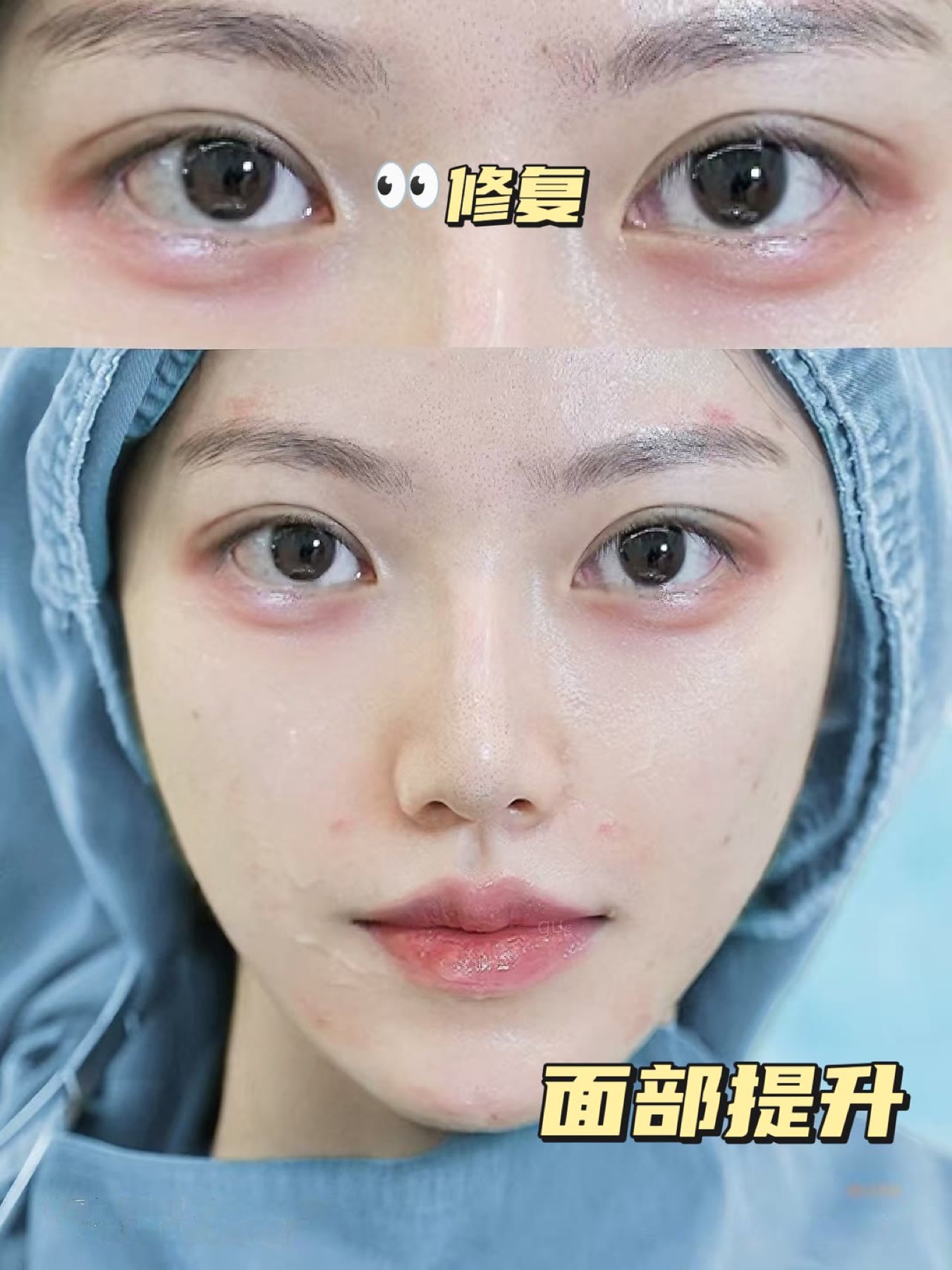 Consented Baby Face case 35