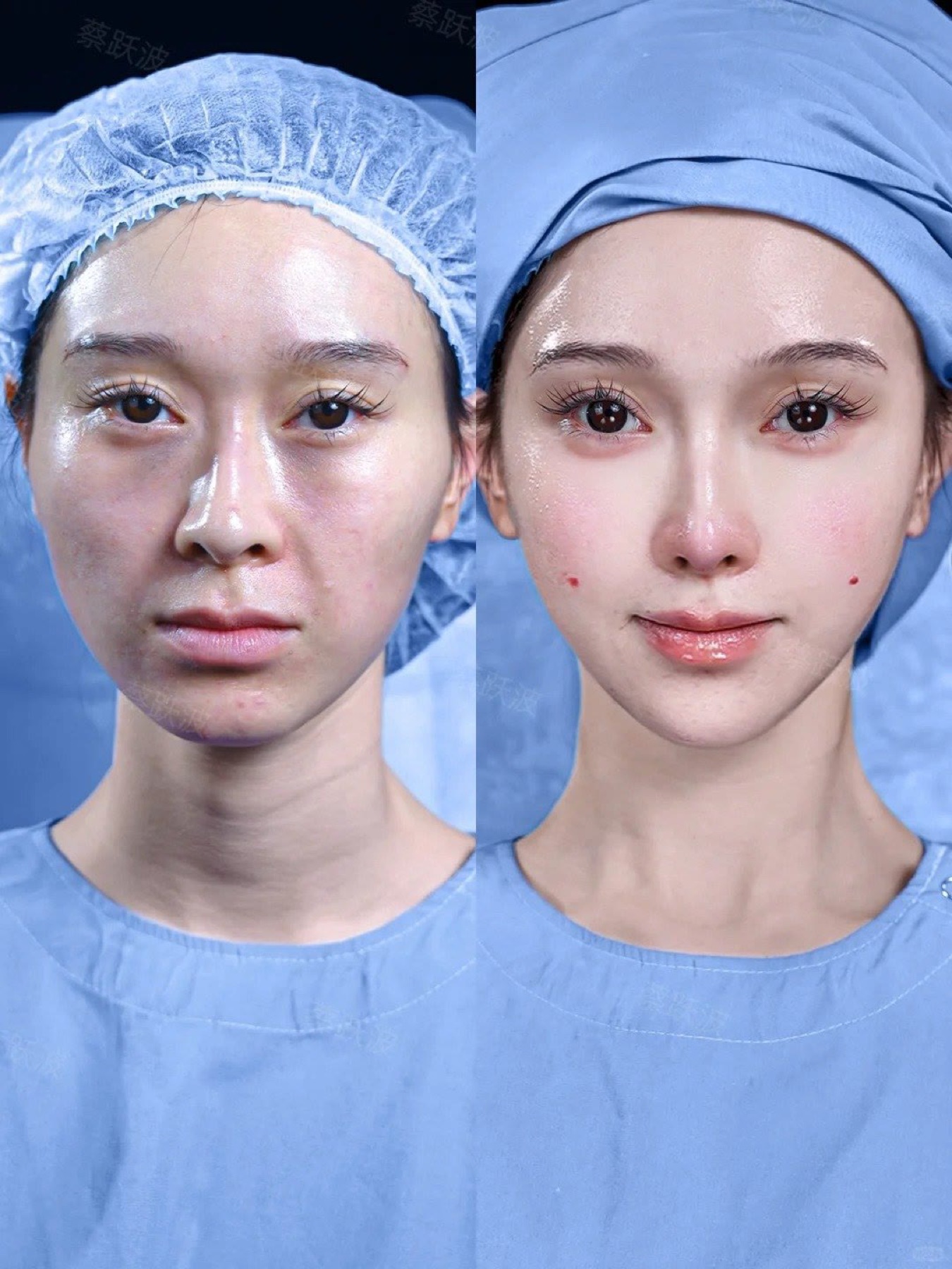 Consented Baby Face case 36