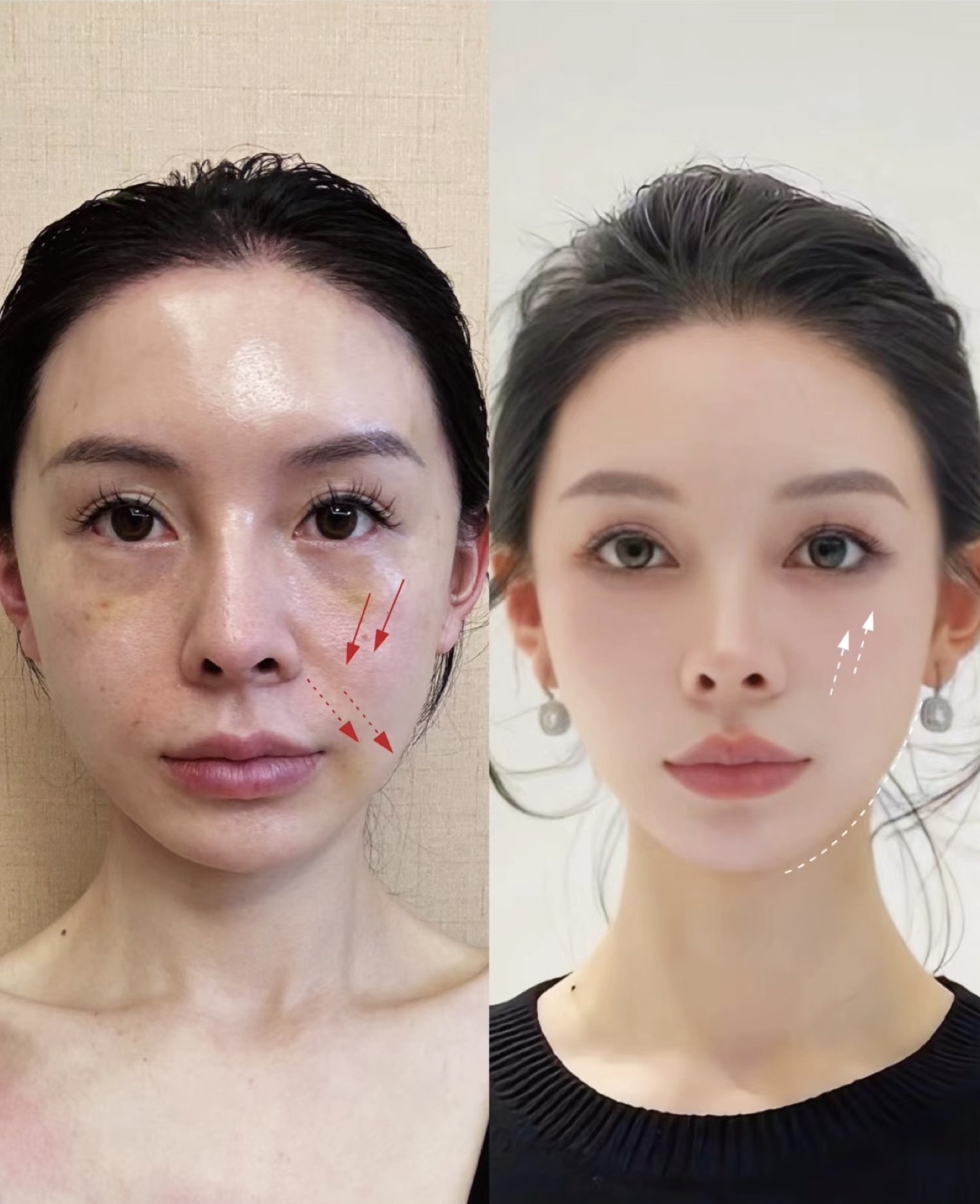 Consented Baby Face case 38