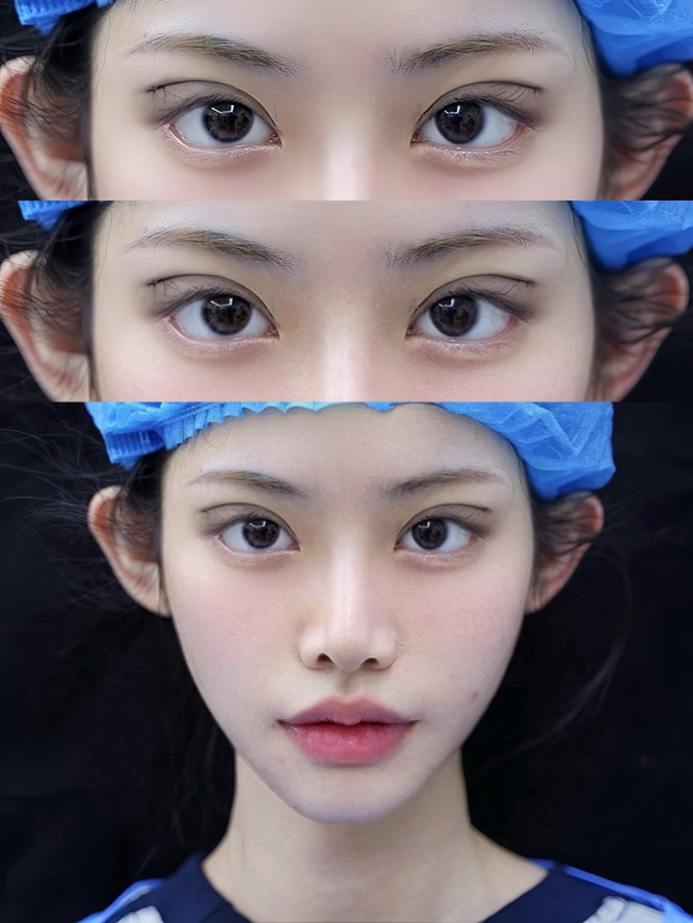 Consented Baby Face case 52