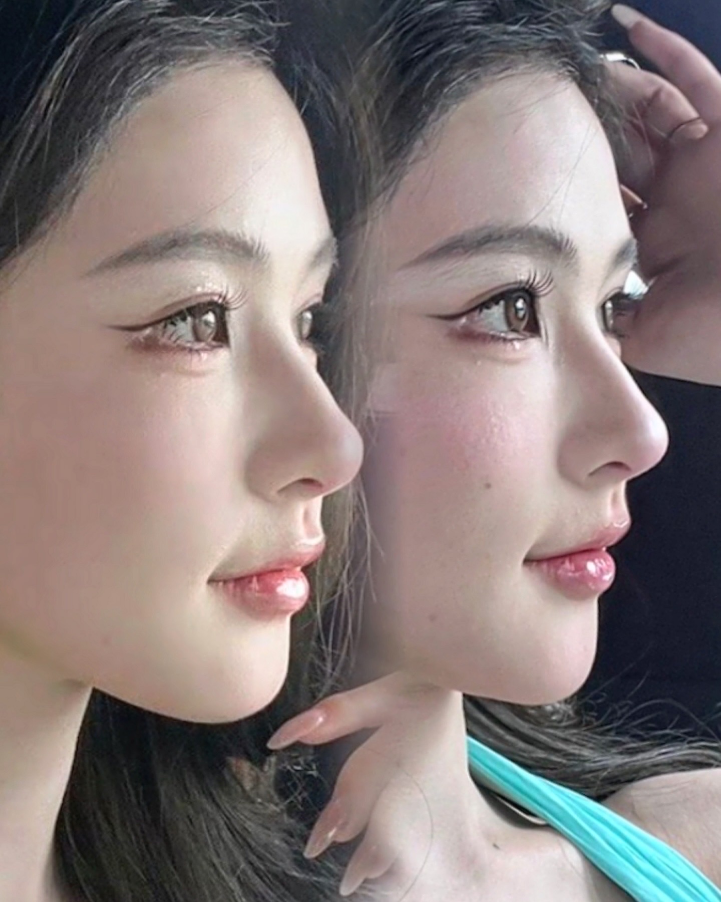 Consented Baby Face case 39