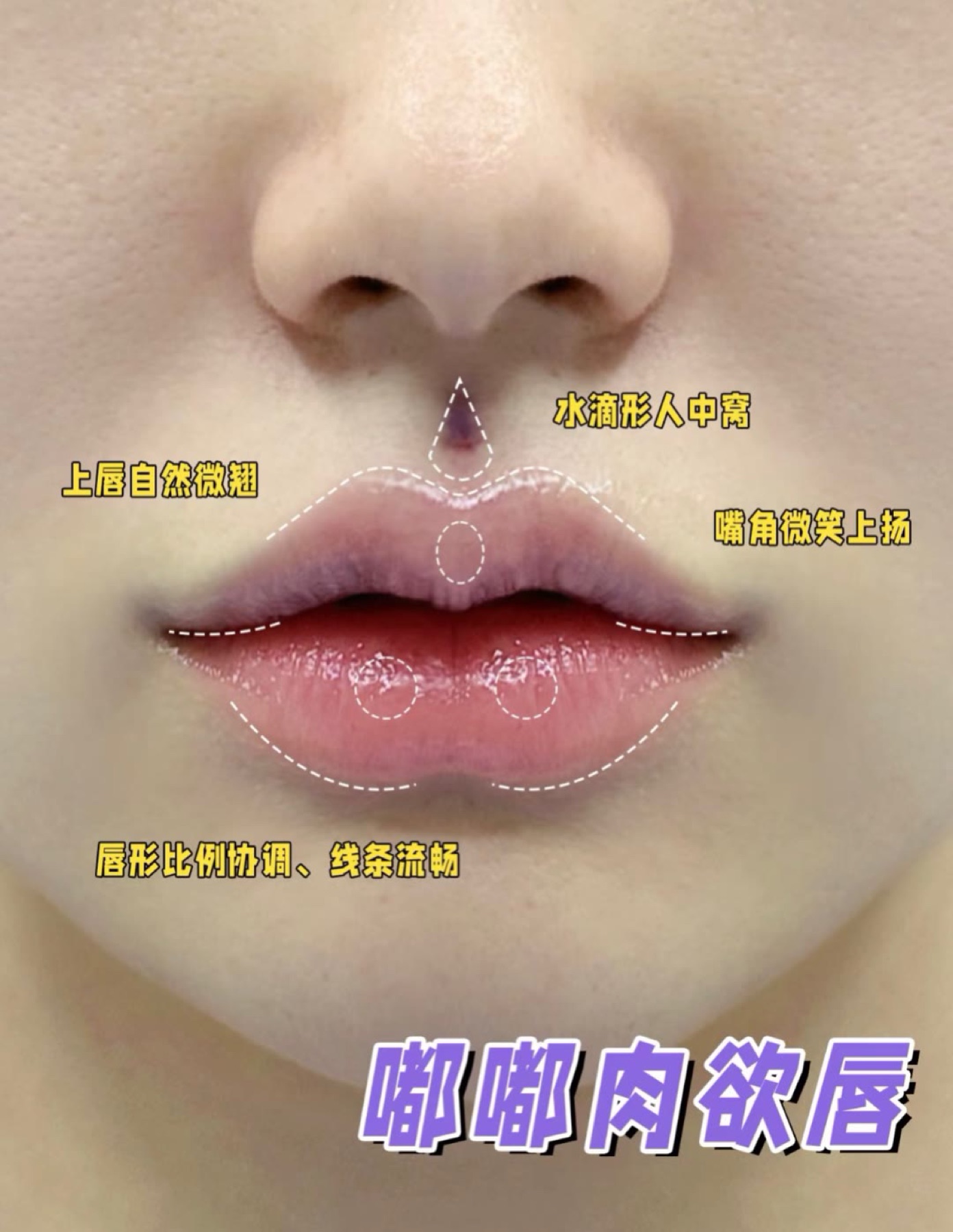 Consented Baby Face case 27