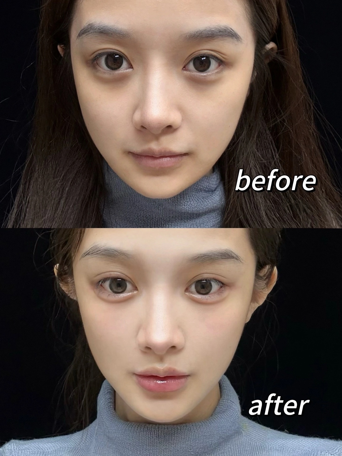 Consented Baby Face case 11