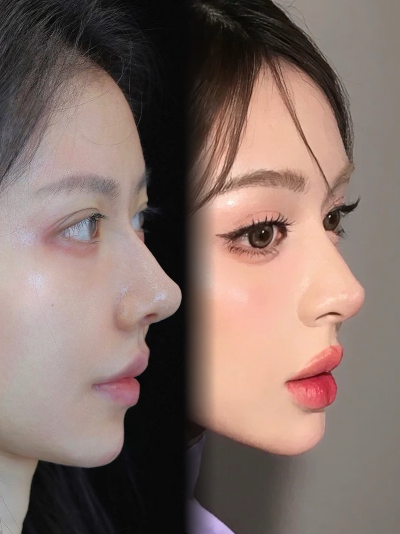 Consented Baby Face case 20