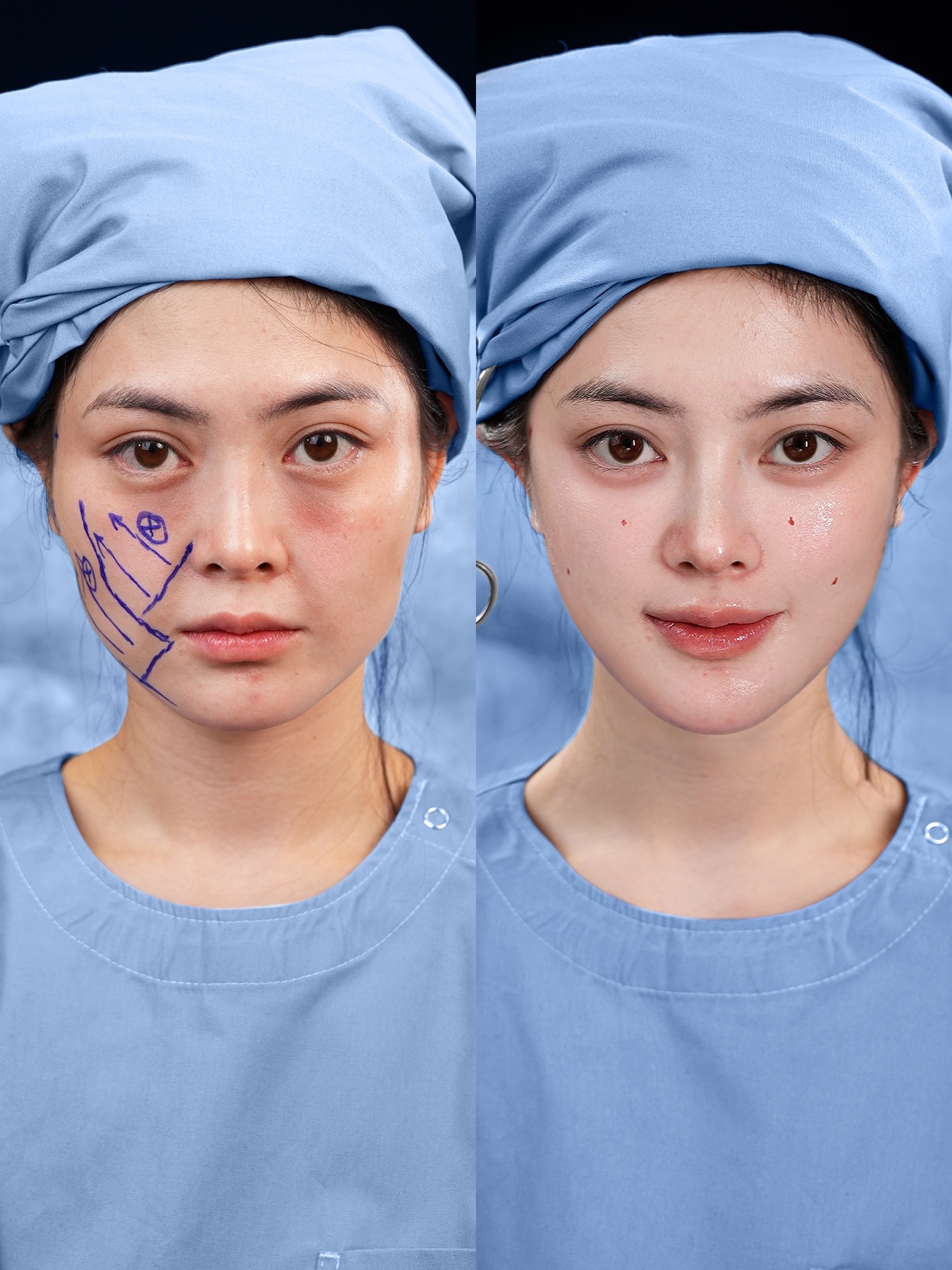 Consented Baby Face case 14